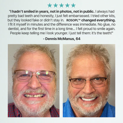 🔥🔥🔥Ends Today: 70% OFF!🦷Pryxo™  Custom-Fit Full Functional Dentures Make you more confident