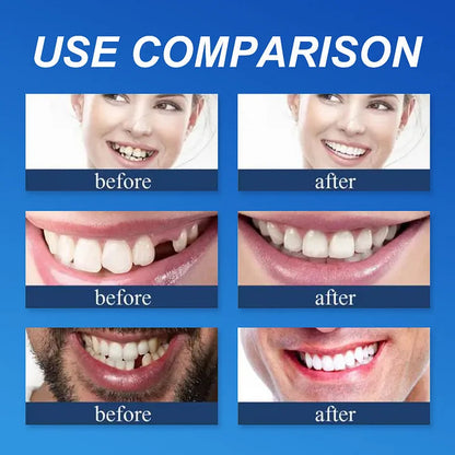 💖Ends Today: 75% OFF! ⏰Pryxo™  Medical Full Denture with Strong Suctiond Custom-Fit Full Functional Dentures🦷Obtain American Dental Association (ADA) Certification