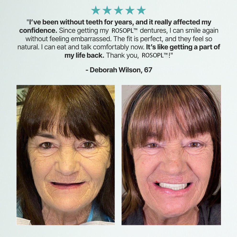 🔥🔥🔥Ends Today: 70% OFF!🦷Pryxo™  Custom-Fit Full Functional Dentures Make you more confident