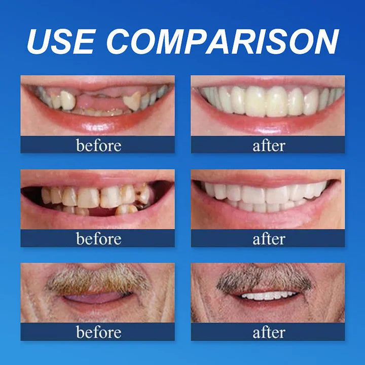 💖Ends Today: 75% OFF! ⏰Pryxo™  Medical Full Denture with Strong Suctiond Custom-Fit Full Functional Dentures🦷Obtain American Dental Association (ADA) Certification